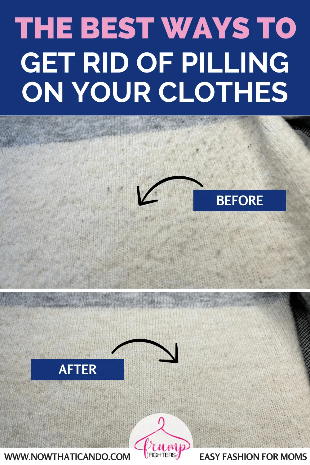Easiest Ways to Remove Pilling from Clothes & Sweaters